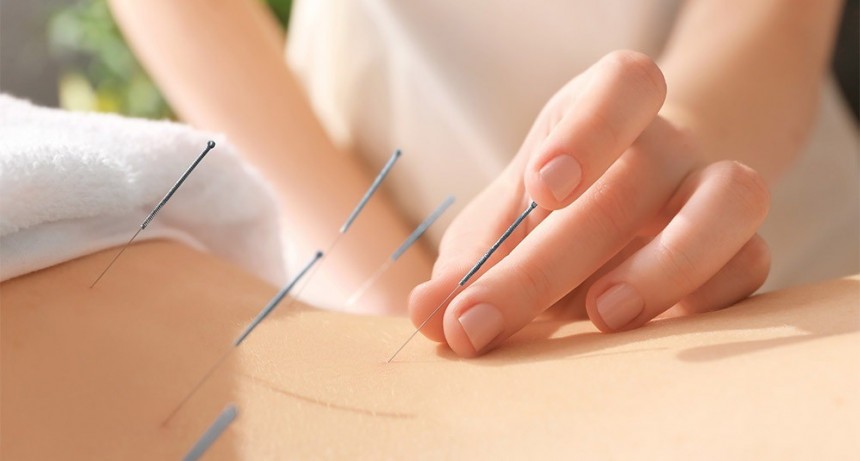 CUAL ES LA TÉCNICA MILENARIA QUE UTILIZAN CADA VEZ MÁS LOS KINESIÓLOGOS PARA SUS TRATAMIENTOS