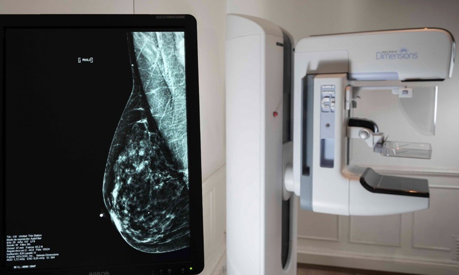 LALCEC realiza mamografías gratuitas para prevenir el cáncer de mama